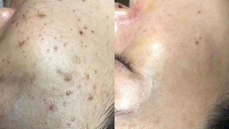 除疤招商加盟项目